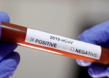 Detaje nga dy të prekurit me coronavirus në Kosovë: Një pacient është 20 vjeç dhe një 77