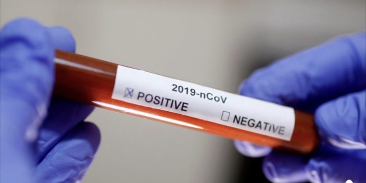 Detaje nga dy të prekurit me coronavirus në Kosovë: Një pacient është 20 vjeç dhe një 77