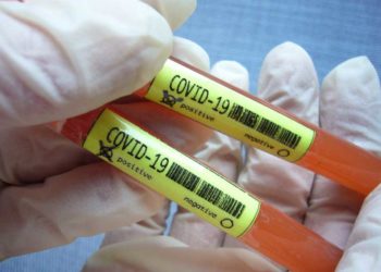 15 raste të reja dhe 4 të shëruar sot nga Covid-19