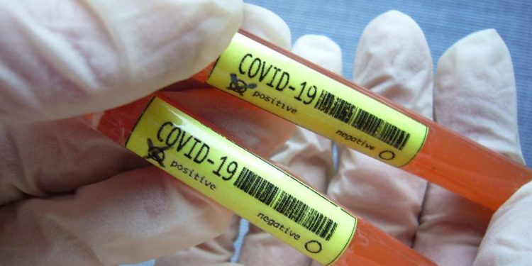 15 raste të reja dhe 4 të shëruar sot nga Covid-19