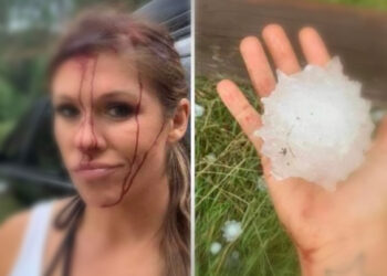 E zë stuhia larg makinës, reporterja gjakoset nga breshri i madh