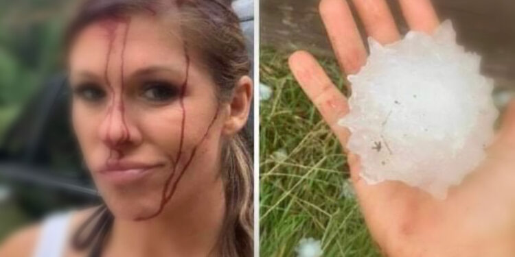 E zë stuhia larg makinës, reporterja gjakoset nga breshri i madh