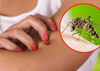 Qytetarët e Kosovës në hall nga mushkonjat, ankesa në çdo kënd