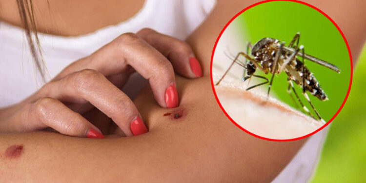 Qytetarët e Kosovës në hall nga mushkonjat, ankesa në çdo kënd