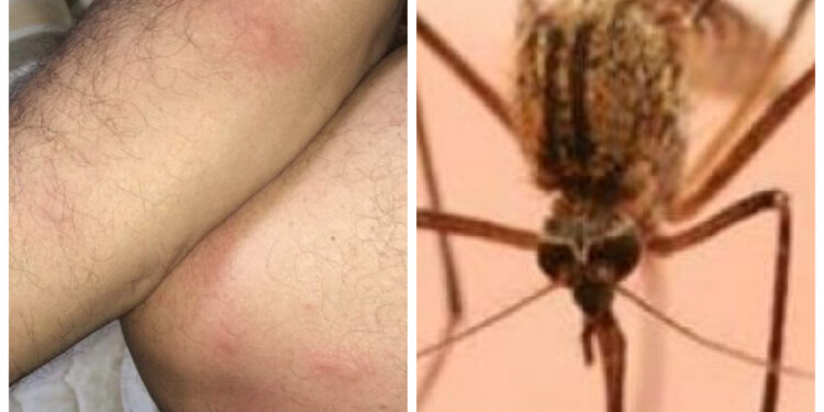 Qytetari publikon fotografi, thotë se u pickua 15 herë nga mushkonjat brenda 15 minutave