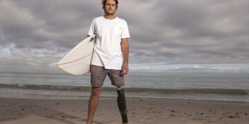 Peshkaqeni i mori një këmbë, fiton të drejtën të mbajë dhëmbin si “suvenir”!