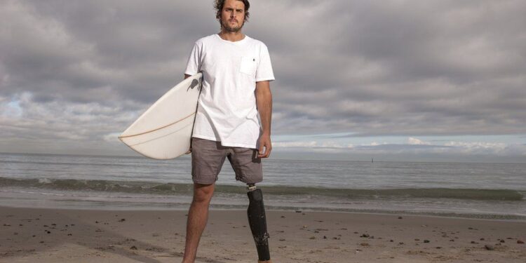 Peshkaqeni i mori një këmbë, fiton të drejtën të mbajë dhëmbin si “suvenir”!