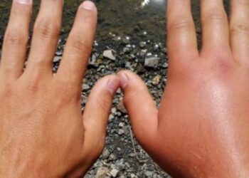 Të gjitha ndryshimet në trup që ndodhin si pasojë e motit