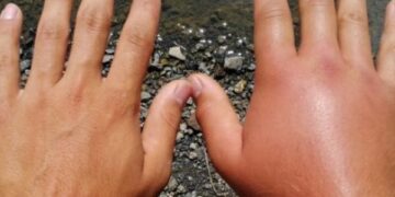 Të gjitha ndryshimet në trup që ndodhin si pasojë e motit